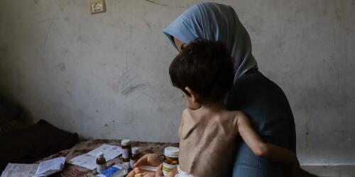 In the Gaza Strip, hunger kills even more than Israeli bombs